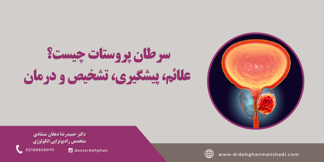 درمان سرطان پروستات