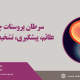 درمان سرطان پروستات