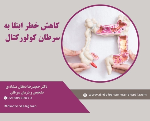 سرطان کولورکتال