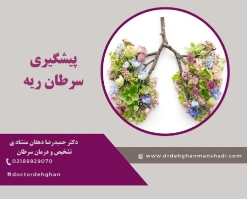سرطان ریه