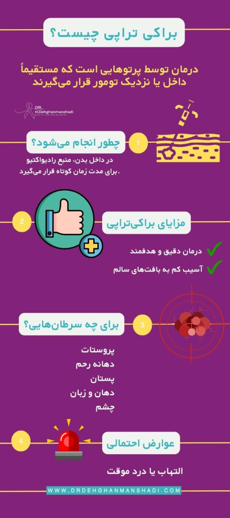 اینوگراف درمان سرطان با براکی تراپی