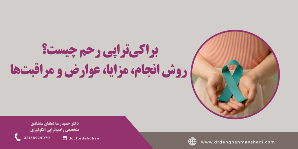 براکی تراپی رحم