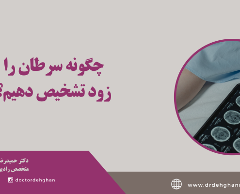 تشخیص زود هنگام سرطان